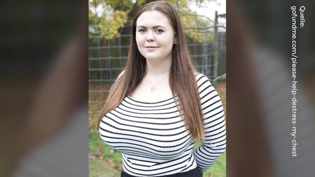 Körbchengröße 75O: Die Brüste dieser Frau wachsen immer weiter Körbchengröße 75O: Die Brüste dieser Frau wachsen immer weiter